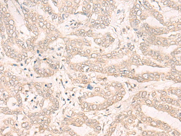 ENO4 Antibody[47109]