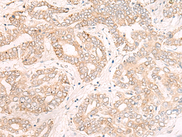 EVPL Antibody[47114]