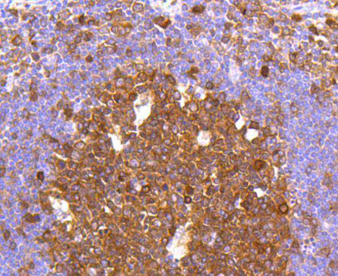 Caspase-3 Rabbit mAb[48658]