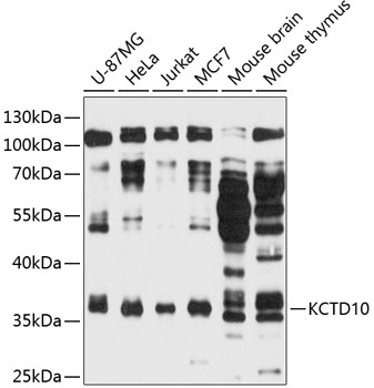 KCTD10 Polyclonal Antibody[275