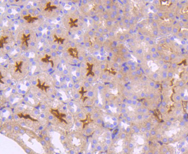 Neuropilin-1 Rabbit mAb[48906]