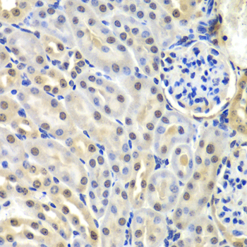 SNRPD2 Polyclonal Antibody[307