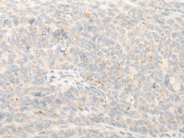 DND1 Antibody[47071]