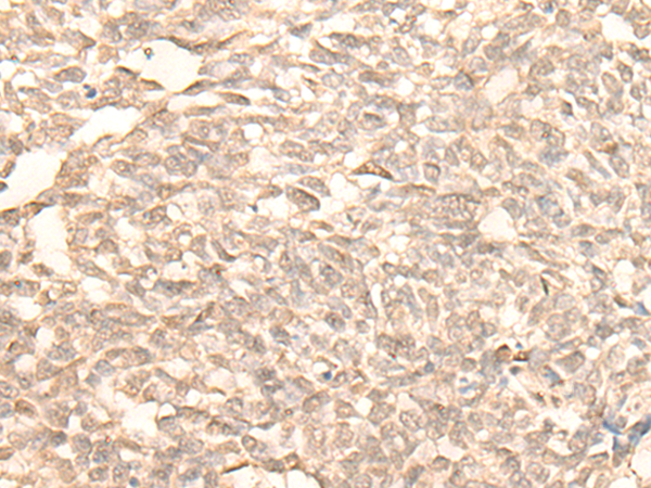 RAD23B Antibody[47184]