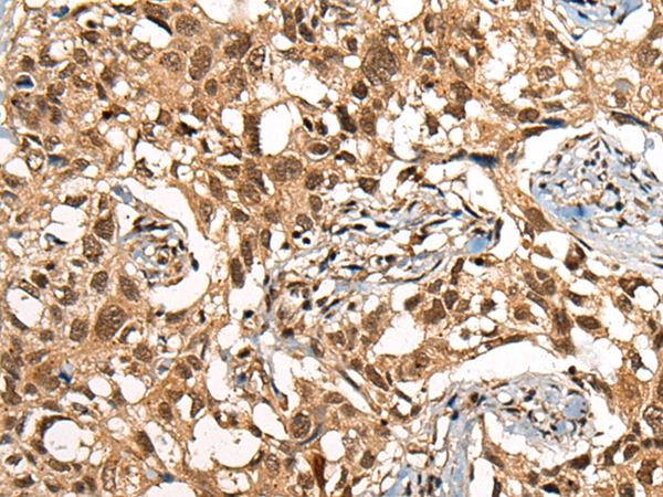 THOC6 Antibody[46683]