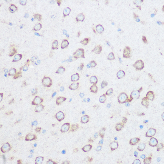CSPG4 Polyclonal Antibody[3047