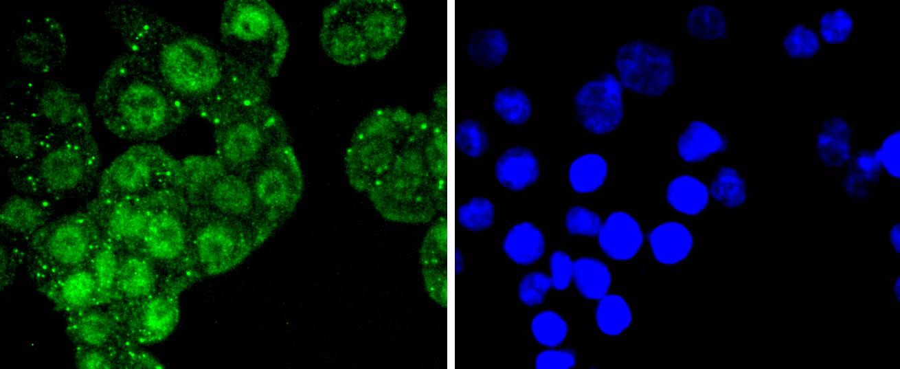 ATF2 Rabbit mAb[48678]
