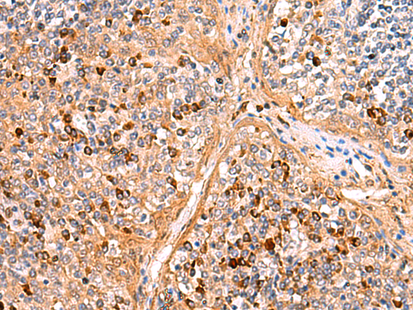 KANSL1L Antibody[47681]
