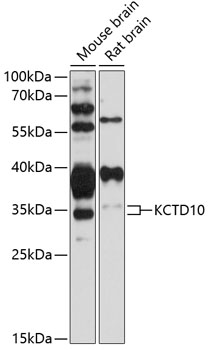 KCTD10 Polyclonal Antibody[276