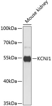 KCNJ1 Polyclonal Antibody[3159