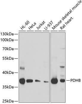 PDHB Polyclonal Antibody[30766