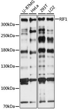 RIF1 Polyclonal Antibody[28853