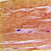 NHE8 Antibody[47857]