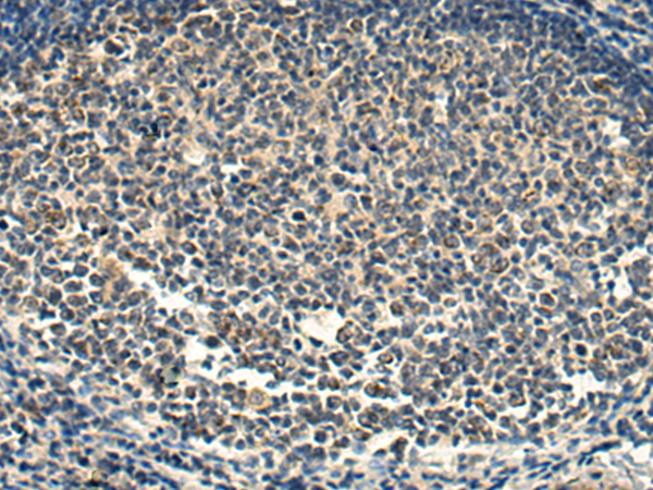 SNAP47 antibody[31815]