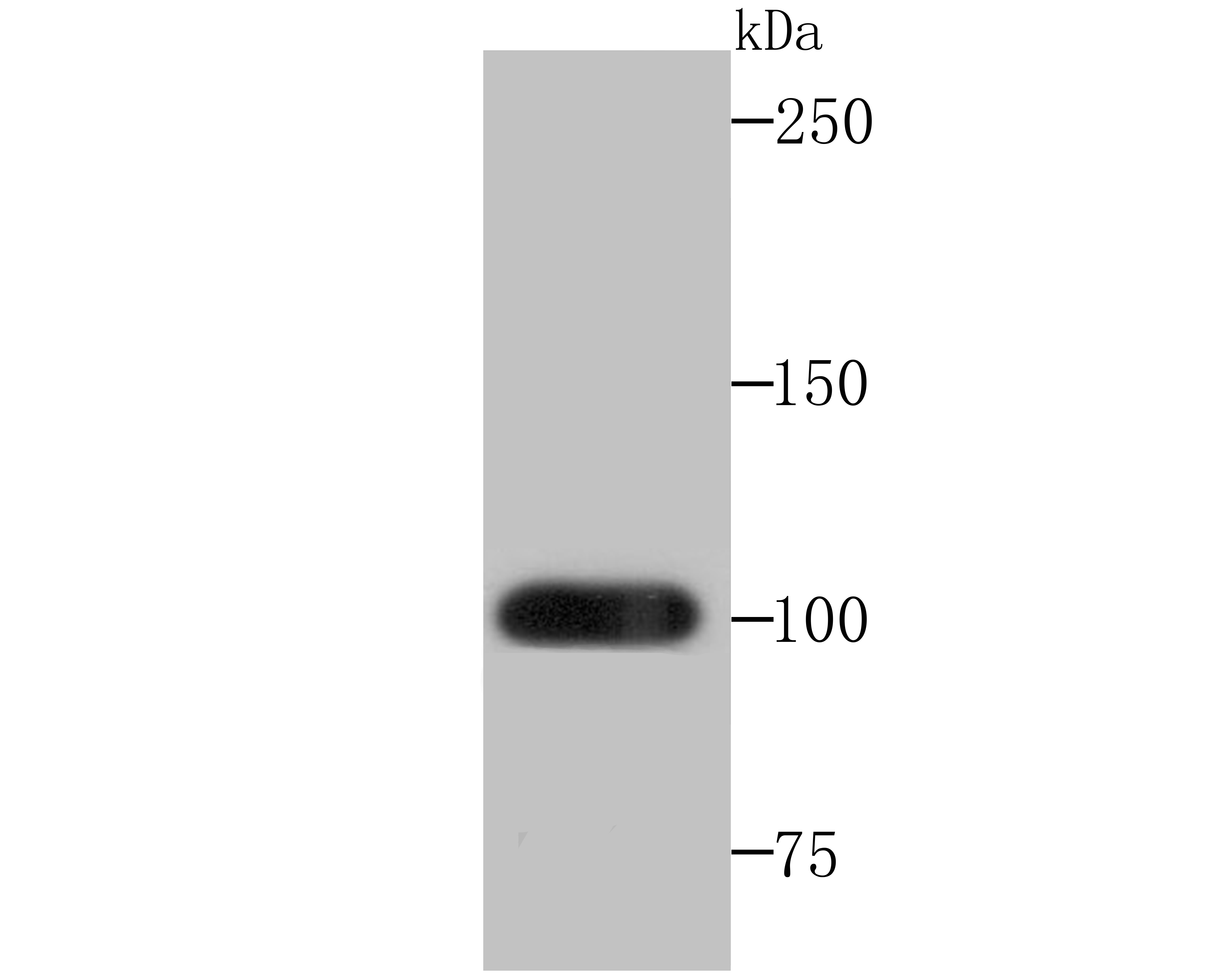 Frizzled 8 Rabbit mAb[49849]