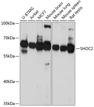 SHOC2 Polyclonal Antibody[3053
