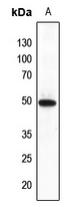 FNTB Antibody[47875]
