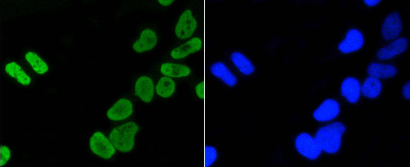 Histone H4(acetyl K5) Rabbit m