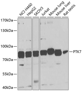 PTK7 Polyclonal Antibody[31752