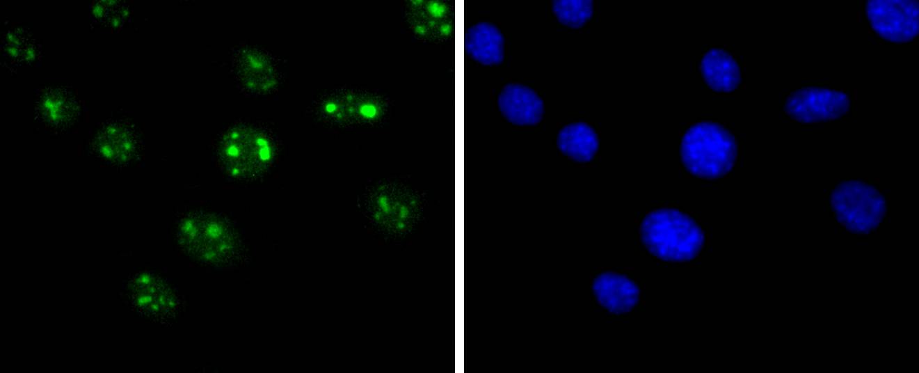 SIRT6 Rabbit mAb[49237]