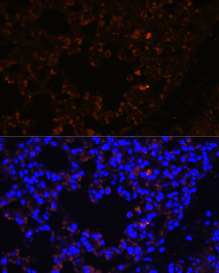 TLR2 Polyclonal Antibody[29071