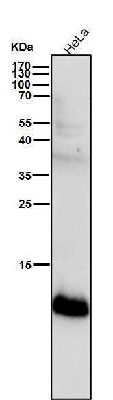 S100A4 Rabbit mAb[49121]