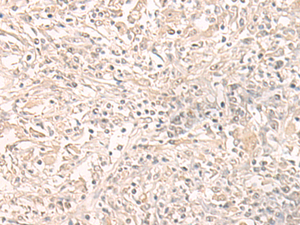 THOP1 Antibody[47258]