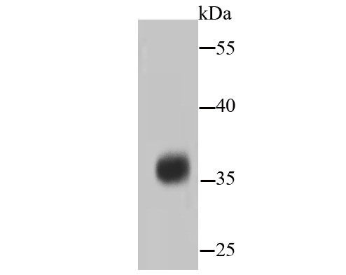 PP2A alpha + beta Rabbit mAb[4