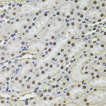 SET Polyclonal Antibody[29117]