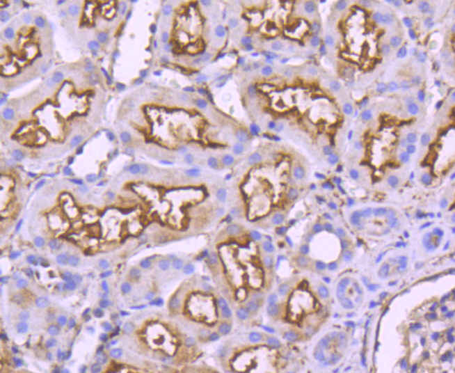 CD10 Rabbit mAb[49098]