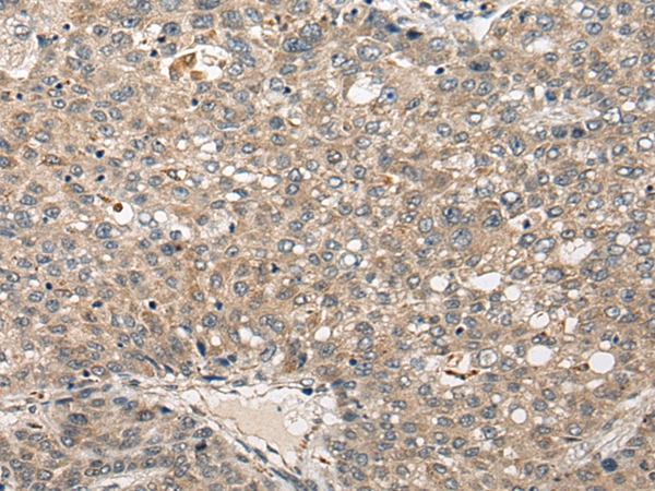 FUT4 Antibody[46565]