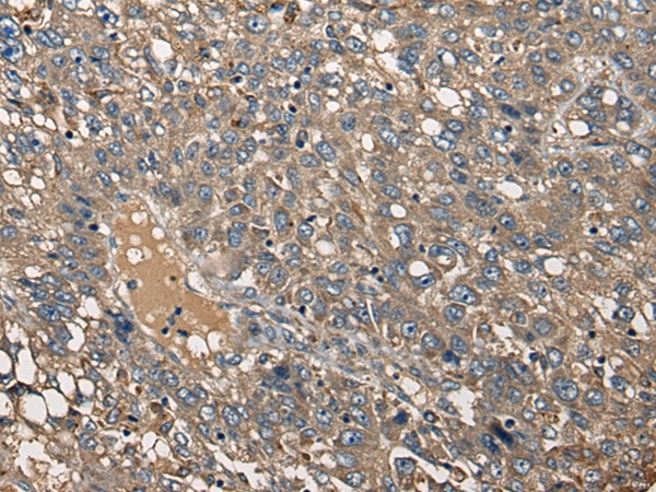 CDC14A Antibody[46440]