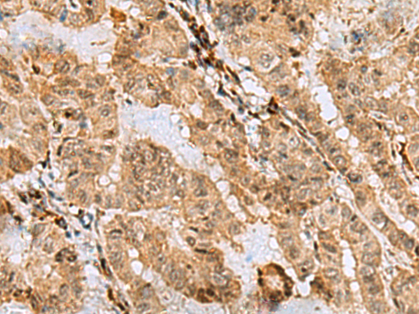 ASNA1 antibody[31907]