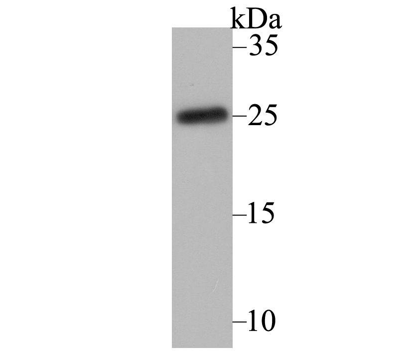 CACNG1 Antibody[48556]