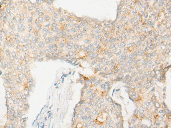 DND1 Antibody[47071]