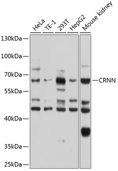 CRNN Polyclonal Antibody[31637