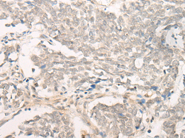 DPP9 Antibody[47076]