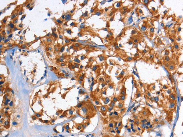 HK1/HK2 antibody[31975]