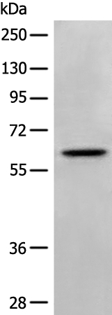 NTNG2 Antibody[46632]