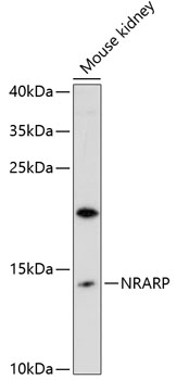 NRARP Polyclonal Antibody[2782