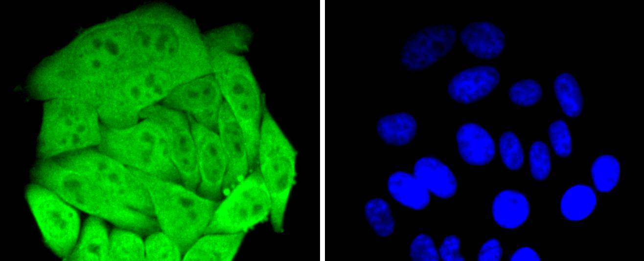 HSPA4 Rabbit mAb[49198]
