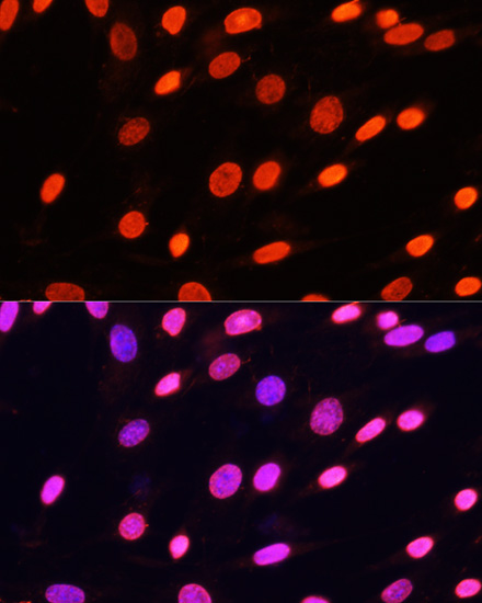 Pan DiMethyl-lysine pAb[30669]