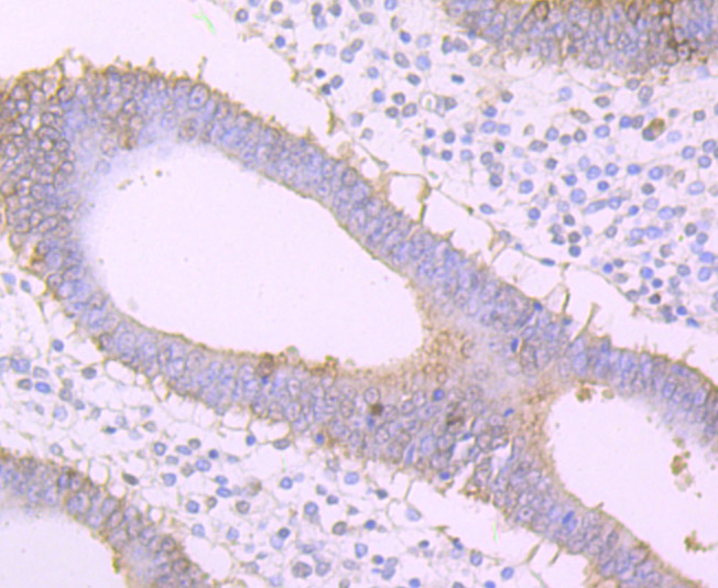 Frizzled 8 Rabbit mAb[49849]