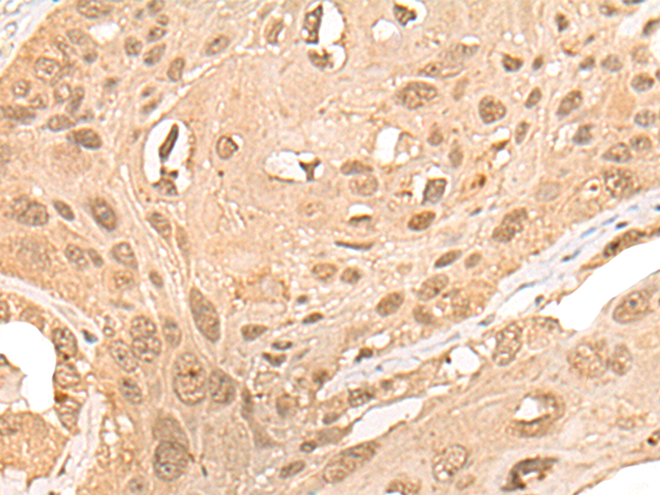 CPNE7 Antibody[46981]