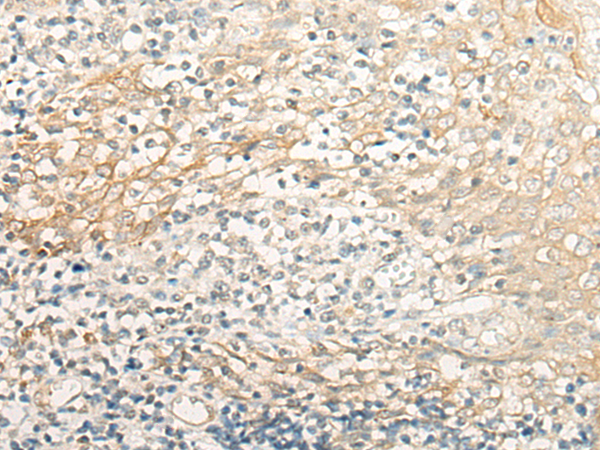 CRB3 Antibody[46989]