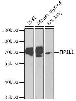 FIP1L1 Polyclonal Antibody[308