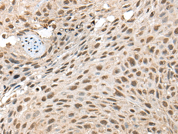 TIMM21 Antibody[46685]