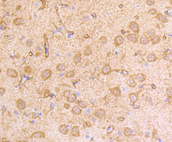 IFNAR1 Rabbit mAb[48656]