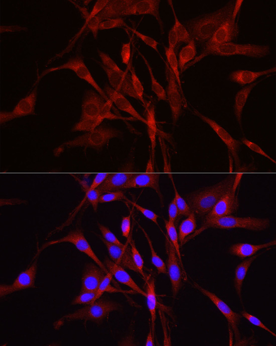 TRIM4 Polyclonal Antibody[2949
