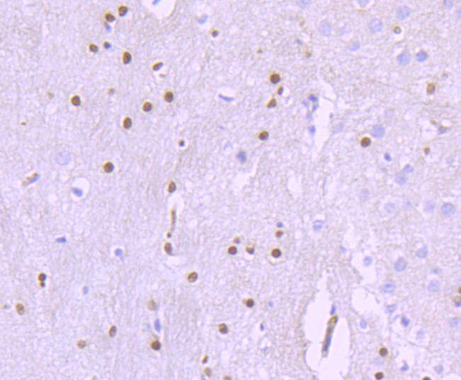 SOX10 Rabbit mAb[49193]